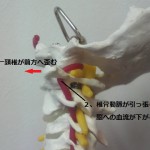 頸椎一番の状態2
