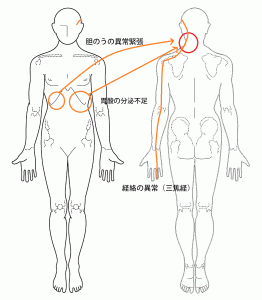 首の痛みの症例1