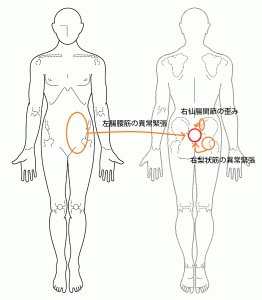 腰痛の症例1