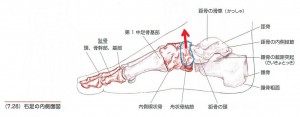 ハイアーチの原因になる骨の歪み