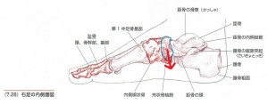 偏平足を引き起こす骨の歪み